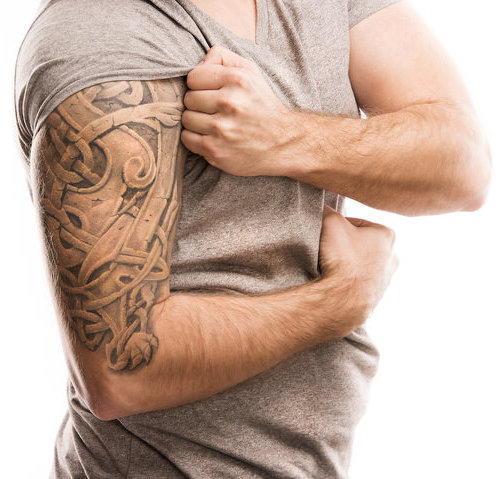 Arm tattoos which can be removed with laser treatment