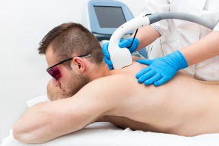 What to Expect from Laser Hair Removal